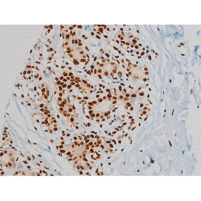 Phospho-Ezrin (Tyr478) Antibody in Immunohistochemistry (Paraffin) (IHC (P))