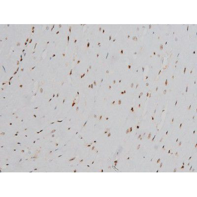 Phospho-Ezrin (Tyr478) Antibody in Immunohistochemistry (Paraffin) (IHC (P))