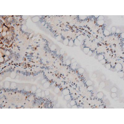 Phospho-Ezrin (Tyr478) Antibody in Immunohistochemistry (Paraffin) (IHC (P))