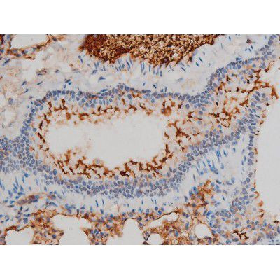 Phospho-Ezrin (Tyr478) Antibody in Immunohistochemistry (Paraffin) (IHC (P))