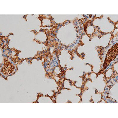 Phospho-Ezrin (Tyr478) Antibody in Immunohistochemistry (Paraffin) (IHC (P))