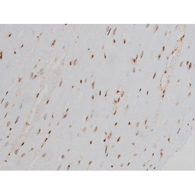 Phospho-Ezrin (Tyr478) Antibody in Immunohistochemistry (Paraffin) (IHC (P))