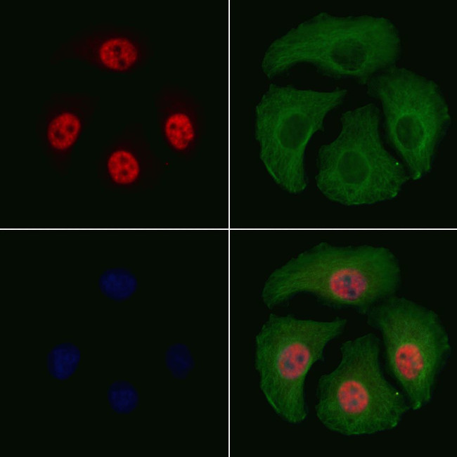 Phospho-ATF2 (Thr69, Thr51) Antibody in Immunocytochemistry (ICC/IF)