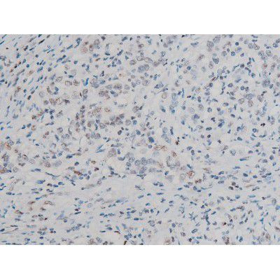 Phospho-ATF2 (Thr69, Thr51) Antibody in Immunohistochemistry (Paraffin) (IHC (P))