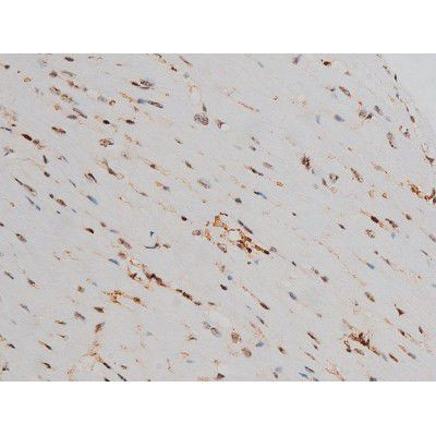 Phospho-ATF2 (Thr69, Thr51) Antibody in Immunohistochemistry (Paraffin) (IHC (P))