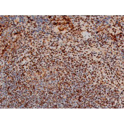 Phospho-ATF2 (Thr69, Thr51) Antibody in Immunohistochemistry (Paraffin) (IHC (P))