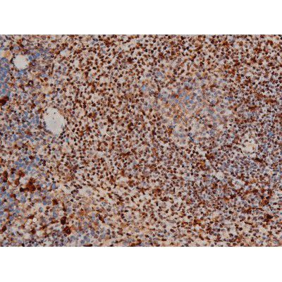 Phospho-ATF2 (Thr69, Thr51) Antibody in Immunohistochemistry (Paraffin) (IHC (P))