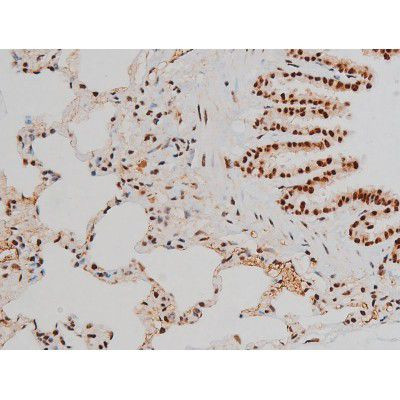 Phospho-ATF2 (Thr69, Thr51) Antibody in Immunohistochemistry (Paraffin) (IHC (P))