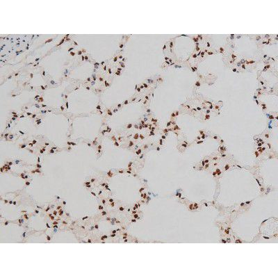 Phospho-ATF2 (Thr69, Thr51) Antibody in Immunohistochemistry (Paraffin) (IHC (P))