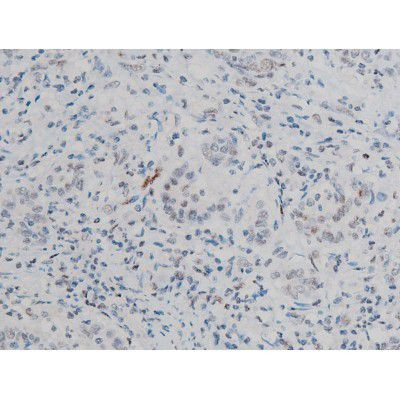 Phospho-ATF2 (Thr69, Thr51) Antibody in Immunohistochemistry (Paraffin) (IHC (P))