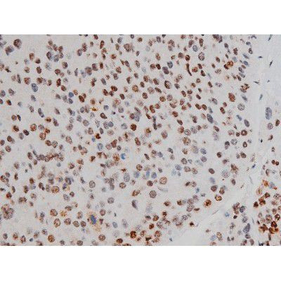 Phospho-ATF2 (Thr69, Thr51) Antibody in Immunohistochemistry (Paraffin) (IHC (P))