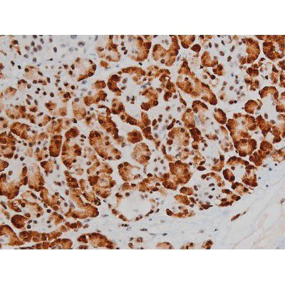 Phospho-ATF2 (Thr69, Thr51) Antibody in Immunohistochemistry (Paraffin) (IHC (P))