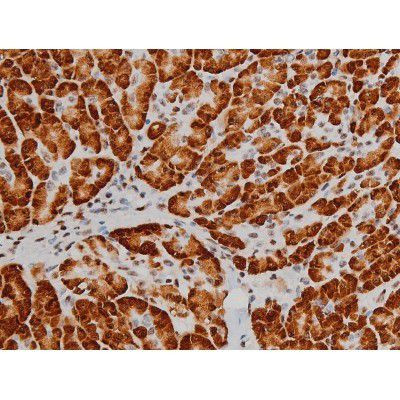 Phospho-ATF2 (Thr69, Thr51) Antibody in Immunohistochemistry (Paraffin) (IHC (P))