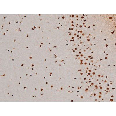 Phospho-ATF2 (Thr69, Thr51) Antibody in Immunohistochemistry (Paraffin) (IHC (P))