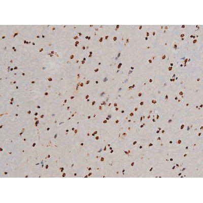 Phospho-ATF2 (Thr69, Thr51) Antibody in Immunohistochemistry (Paraffin) (IHC (P))