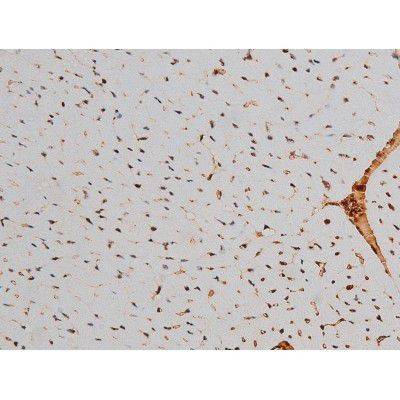 Phospho-ATF2 (Thr69, Thr51) Antibody in Immunohistochemistry (Paraffin) (IHC (P))