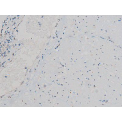 Phospho-ATF2 (Thr71, Thr53) Antibody in Immunohistochemistry (Paraffin) (IHC (P))