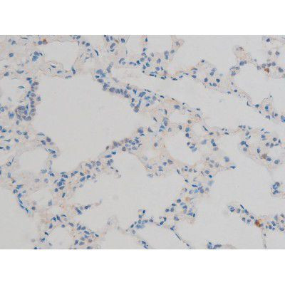 Phospho-ATF2 (Thr71, Thr53) Antibody in Immunohistochemistry (Paraffin) (IHC (P))