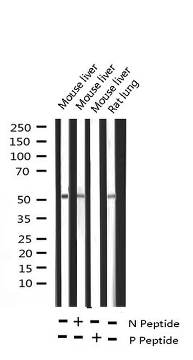 Phospho-ATF2 (Thr71, Thr53) Antibody in Western Blot (WB)
