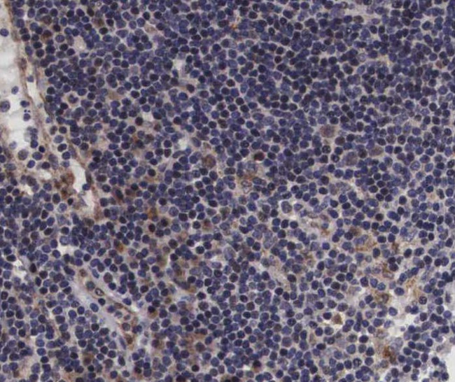 Phospho-VAV1 (Tyr174) Antibody in Immunohistochemistry (Paraffin) (IHC (P))