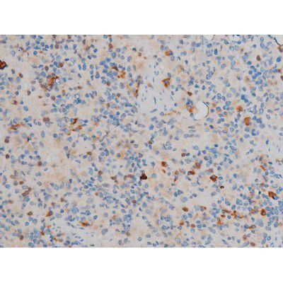 Phospho-CREB (Ser142) Antibody in Immunohistochemistry (Paraffin) (IHC (P))