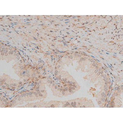 Phospho-CREB (Ser142) Antibody in Immunohistochemistry (Paraffin) (IHC (P))