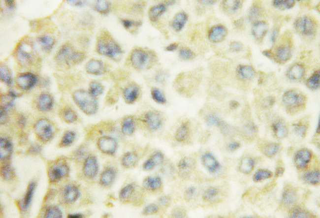 Phospho-PKC Pan (Thr497) Antibody in Immunohistochemistry (Paraffin) (IHC (P))