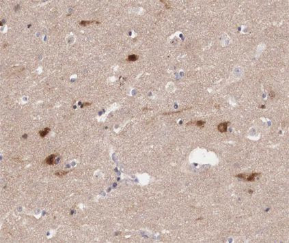 Phospho-JunB (Ser259) Antibody in Immunohistochemistry (Paraffin) (IHC (P))