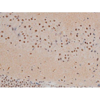 Phospho-JunD (Ser255) Antibody in Immunohistochemistry (Paraffin) (IHC (P))