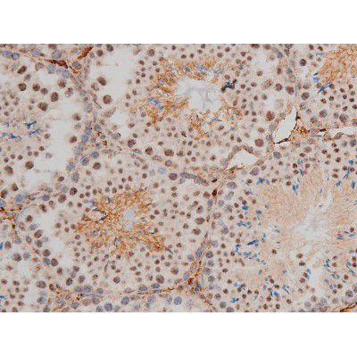 Phospho-JunD (Ser255) Antibody in Immunohistochemistry (Paraffin) (IHC (P))