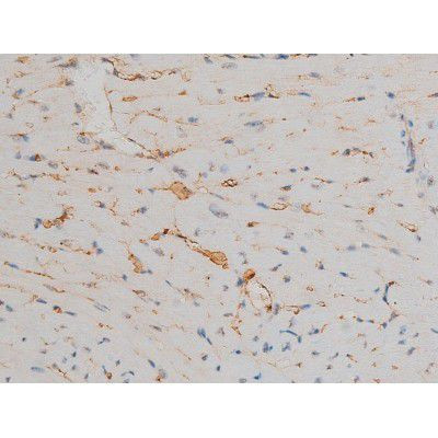 Phospho-JunD (Ser255) Antibody in Immunohistochemistry (Paraffin) (IHC (P))