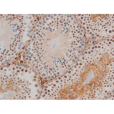 Phospho-JunD (Ser255) Antibody in Immunohistochemistry (Paraffin) (IHC (P))