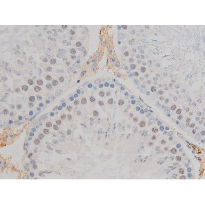 Phospho-JunD (Ser255) Antibody in Immunohistochemistry (Paraffin) (IHC (P))