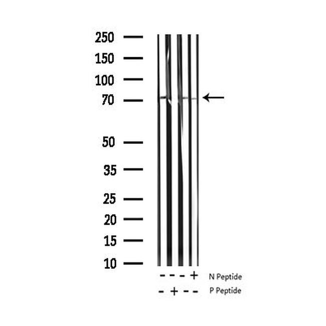 Phospho-Synapsin 1 (Ser9) Antibody in Western Blot (WB)