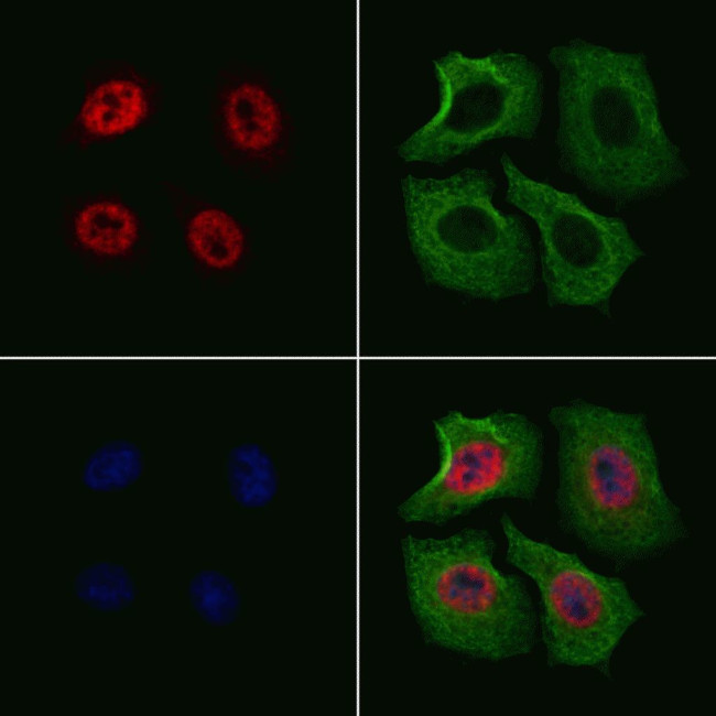 Phospho-Elk1 (Ser383) Antibody in Immunocytochemistry (ICC/IF)