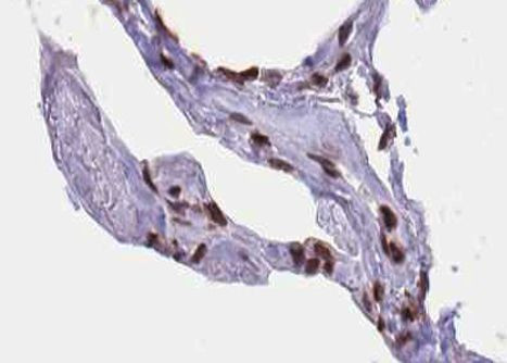 Phospho-Elk1 (Ser389) Antibody in Immunohistochemistry (Paraffin) (IHC (P))