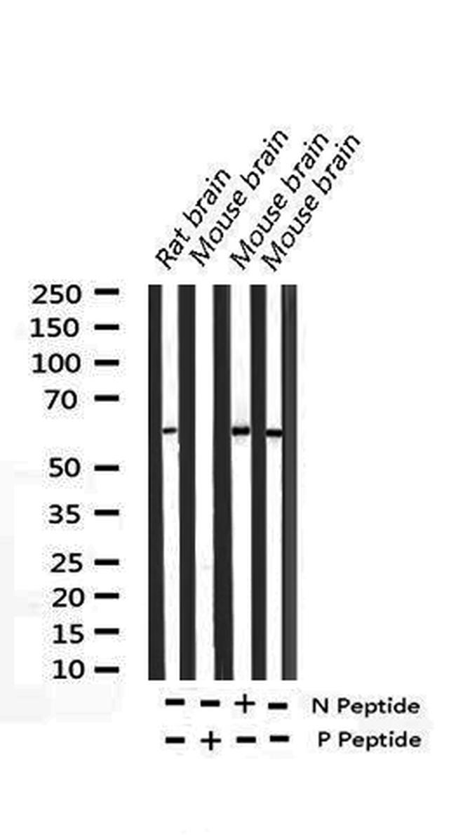 Phospho-Elk1 (Ser389) Antibody in Western Blot (WB)