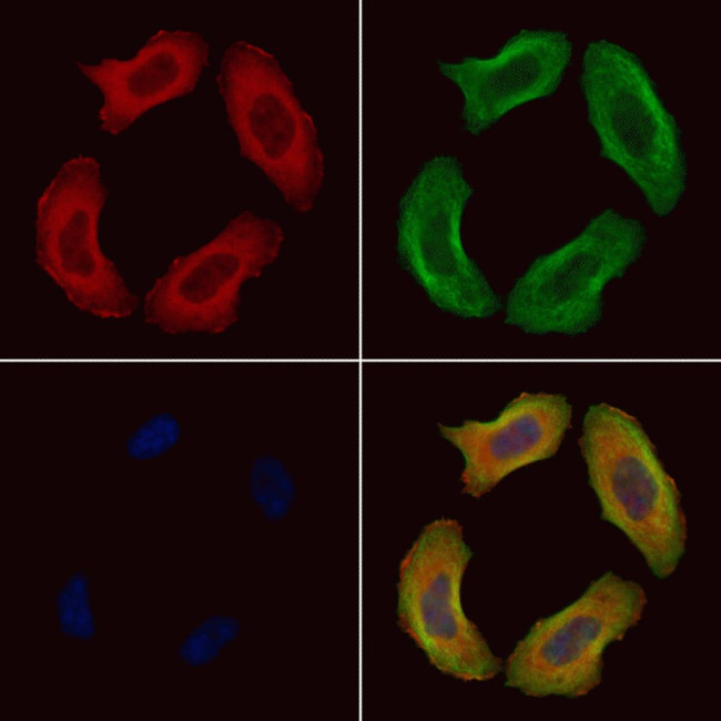 Phospho-Filamin A (Ser2152) Antibody in Immunocytochemistry (ICC/IF)