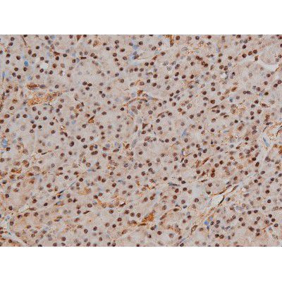 Phospho-Filamin A (Ser2152) Antibody in Immunohistochemistry (Paraffin) (IHC (P))