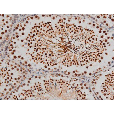 Phospho-Filamin A (Ser2152) Antibody in Immunohistochemistry (Paraffin) (IHC (P))