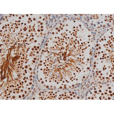 Phospho-Filamin A (Ser2152) Antibody in Immunohistochemistry (Paraffin) (IHC (P))