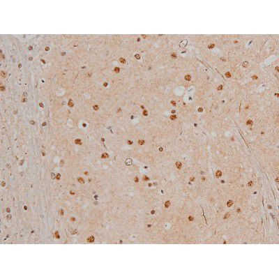 Phospho-Filamin A (Ser2152) Antibody in Immunohistochemistry (Paraffin) (IHC (P))