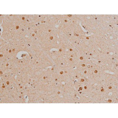 Phospho-Filamin A (Ser2152) Antibody in Immunohistochemistry (Paraffin) (IHC (P))