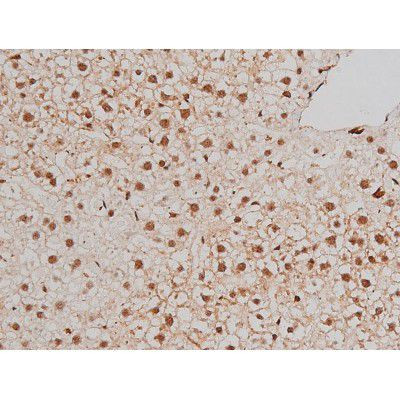 Phospho-Filamin A (Ser2152) Antibody in Immunohistochemistry (Paraffin) (IHC (P))