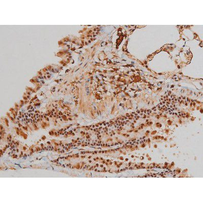 Phospho-Filamin A (Ser2152) Antibody in Immunohistochemistry (Paraffin) (IHC (P))