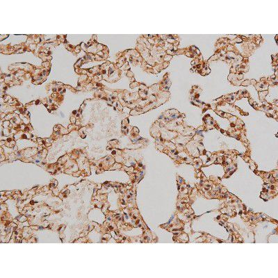 Phospho-Filamin A (Ser2152) Antibody in Immunohistochemistry (Paraffin) (IHC (P))