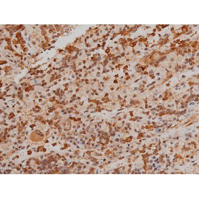 Phospho-Filamin A (Ser2152) Antibody in Immunohistochemistry (Paraffin) (IHC (P))