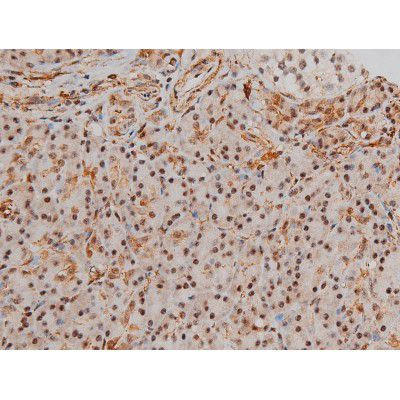 Phospho-Filamin A (Ser2152) Antibody in Immunohistochemistry (Paraffin) (IHC (P))