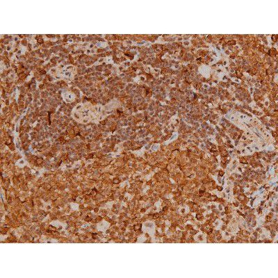 Phospho-Filamin A (Ser2152) Antibody in Immunohistochemistry (Paraffin) (IHC (P))