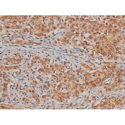 Phospho-Filamin A (Ser2152) Antibody in Immunohistochemistry (Paraffin) (IHC (P))